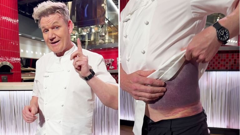 Gordon Ramsay „hat Glück“, nach schlimmem Fahrradunfall noch am Leben zu sein